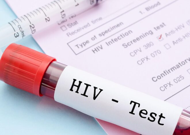 Awal 2026 Mengkhawatirkan! 7 Kasus HIV Baru Terdeteksi di Sumbawa, Dinkes Gencarkan Tracing Komunitas Kunci